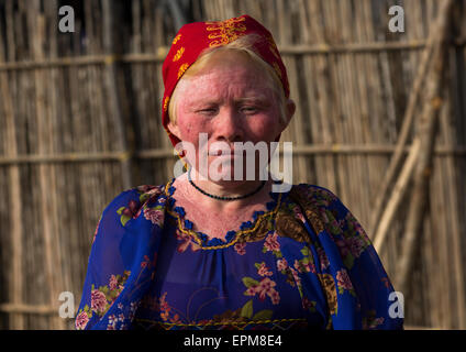 Panama, San Blas Inseln, Mamitupu, Porträt einer Albino-Stamm der Kuna-Frau Stockfoto