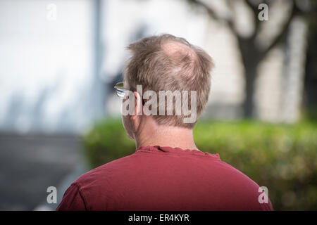 Hinterkopf Kerl Glatzenbildung Stockfoto