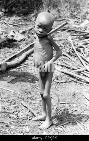 Opfer des nigerianischen Bürgerkrieges, auch bekannt als der nigerianischen Biafra-Krieges. Juli 1968. Stockfoto