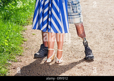 Medizinische Amputation Bein Stockfoto, Bild: 4431588 - Alamy