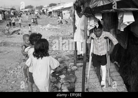 Junge mit Bein in Gips auf Krücken; Malvani Slum; Malad; Bombay Mumbai; Maharashtra; Indien Stockfoto