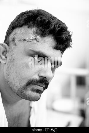 Abdul Rashid Bürgerin verletzten erholt sich im Krankenhaus JJ während den letzten Bombe am 26. November 2008 sprengt Mumbai Stockfoto