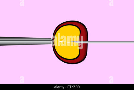 Farbige abstrakte flache Darstellung Symbol für künstliche Befruchtung in vitro auf rosa Hintergrund. Stockfoto