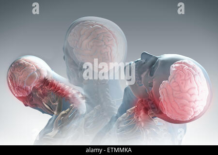 Konzeptionelle Darstellung der Phasen der Bewegung dieser Ursache Schleudertrauma: Rückzug, Erweiterung und Erholung. Stockfoto