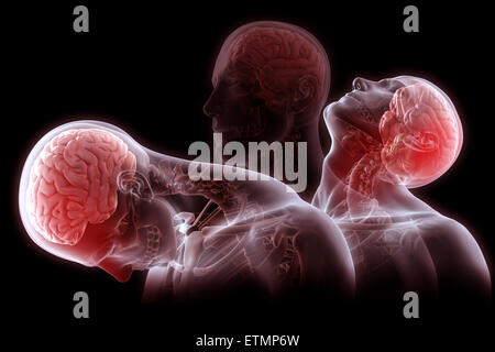 Konzeptionelle Darstellung der Phasen der Bewegung dieser Ursache Schleudertrauma: Rückzug, Erweiterung und Erholung. Stockfoto