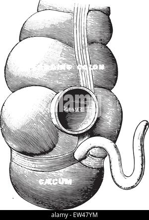 Diagramm zur Veranschaulichung der Union des Dünndarms mit der großen, Vintage gravierte Darstellung. Stock Vektor