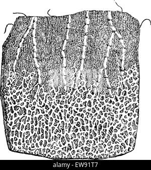 (1) lymphatische System. (2) Lymphgefäße, graviert Vintage Illustration. Üblichen Medizin Wörterbuch - Paul Labarthe - 1885. Stock Vektor