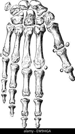 Skelett der Hand und der Finger, graviert Vintage Illustration. Üblichen Medizin Wörterbuch - Paul Labarthe - 1885. Stock Vektor