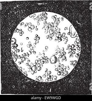 Alten graviert Abbildung frische Butter unter Mikroskop. Industrielle Enzyklopädie E.-O. Lami - 1875. Stock Vektor