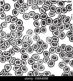 Rote Blutkörperchen oder Erythrozyten, Vintage Gravur. Alten gravierte Darstellung der roten Blutkörperchen. Stock Vektor