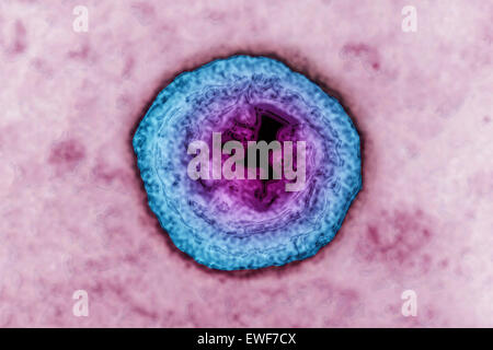 HERPES-SIMPLEX-VIRUS Stockfoto