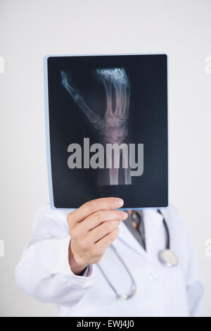 Frau Doktor mit weißen Kleid und Stethoskop mit schwarzen Röntgen der Hand Skelett in ihren Händen isoliert auf weißem Hintergrund Stockfoto