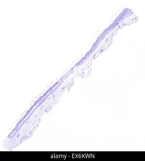 Cytokeratin 1: Immunoperoxidase Färbung von Formalin fixiert, Paraffin-eingebetteten Maus Haut zeigen Zytoplasma Färbung in der epidermis Stockfoto