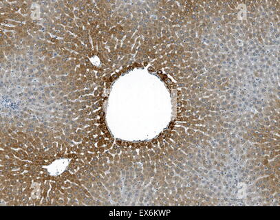 Immunoperoxidase Färbung von Formalin fixiert, Paraffin eingebettet, TCDD behandelt Ratte Leber zeigt eine Centrilobular Zytoplasma der Hepatozyten Färbung. Stockfoto