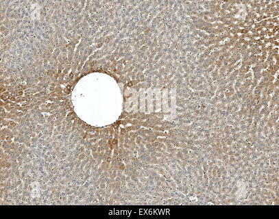 Cyp1A2: Immunoperoxidase Färbung von Formalin fixiert, Paraffin eingebettet, TCDD behandelt Ratte-Leber zeigt Centrilobular Färbung Zytoplasma der Hepatozyten Stockfoto