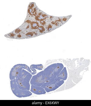 CD79a: Immunoperoxidase Färbung des Formalin fixiert, Paraffin-eingebetteten Maus Milz und Thymus zeigt Zellmembran Färbung in den Β-Zellen Stockfoto