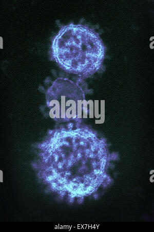 Eingefärbte Transmission Electron Schliffbild des Nahen Osten respiratorische Syndrom Coronavirus (MERS-CoV) Virionen Stockfoto