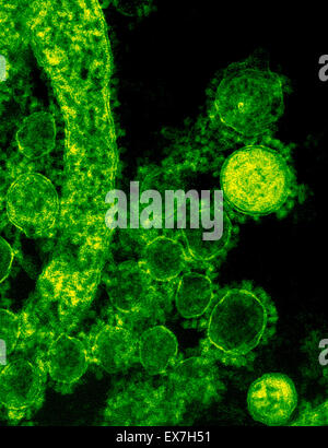 Eingefärbte Transmission Electron Schliffbild des Nahen Osten respiratorische Syndrom Coronavirus (MERS-CoV) Virionen Stockfoto