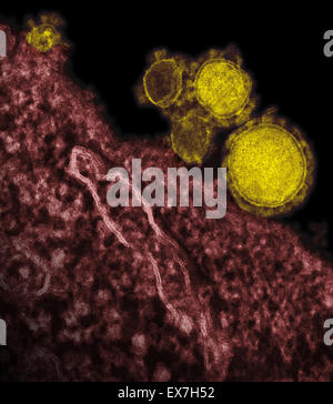 Eingefärbte Transmission Electron Schliffbild des Nahen Osten respiratorische Syndrom Coronavirus (MERS-CoV) Virionen Stockfoto