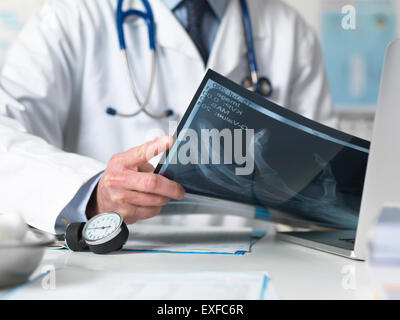 Schuss des Arztes anzeigen Röntgen Hand in Klinik beschnitten Stockfoto