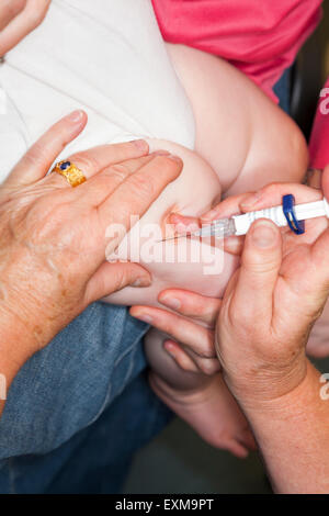 MMR etc. Immunisierung / Impfung / jab / aus einer Spritze in eine einjährige / 12 13 12:13 Monate Baby Oberschenkel / Bein. Stockfoto