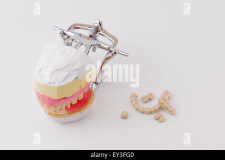 der Zahnersatz im Dentallabor hergestellt Stockfoto