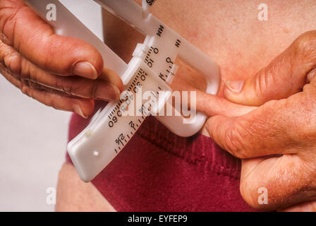 Mit einer Prise Haut, werden Mess Bremssättel verwendet, um eine Frau mittleren Alters subkutane Körperfettanteil bestimmen. Stockfoto