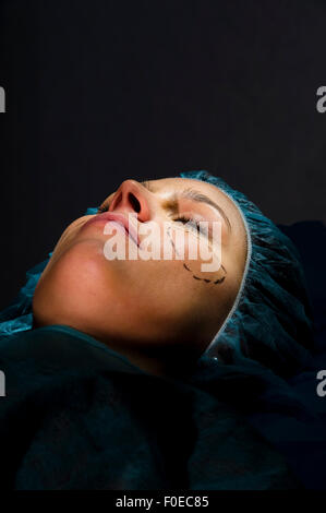 Frau in plastische Chirurgie Stockfoto