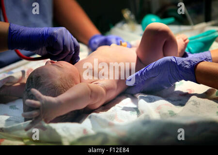 Die ersten Minuten des Lebens des neugeborenen Mädchens Stockfoto