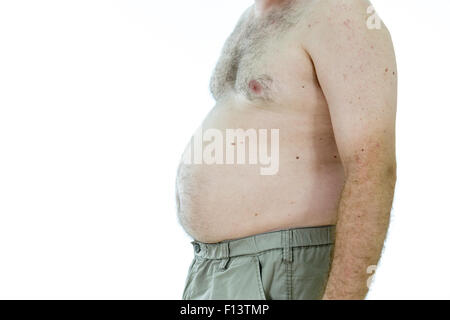 Übergewichtigen Mann mit dicken Bauch, Seitenansicht Stockfoto