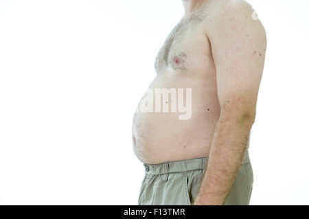 Übergewichtigen Mann mit dicken Bauch, Seitenansicht Stockfoto