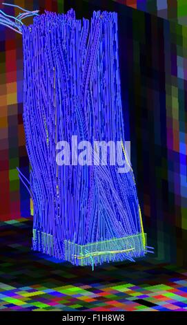 Faser-Traktate des menschlichen Rückenmarks in einer kleinen Region of interest Stockfoto