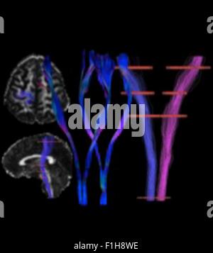 Die kortikalen spinalen Trakt, motor-Darm-Trakt, links und rechts, in ein menschliches Subjekt Stockfoto