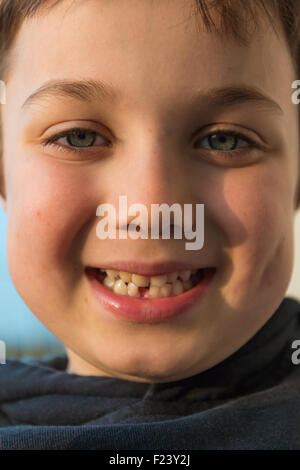 Kleiner Junge mit fehlenden vorderen Zahn Zahnfee warten Stockfoto