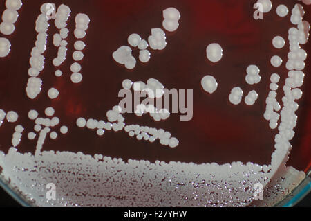 Bakterienkolonien Schafe Blut Medium auf einer Petrischale wachsen Stockfoto