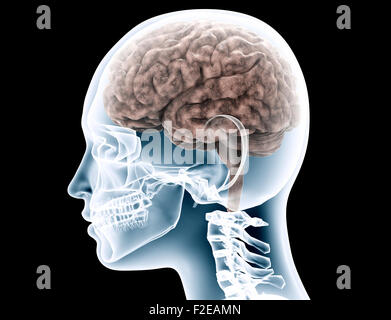 XRAY ein Womans Scull auf schwarz mit Beschneidungspfad. Stockfoto