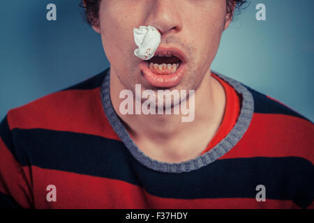 Junger Mann mit Gewebe seine Nasenflügel hat Nasenbluten sowie Fieberbläschen auf seine Lippe Stockfoto