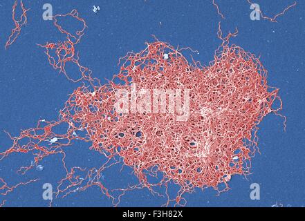 SEM Borrelia Burgdorferi-Bakterium Stockfoto