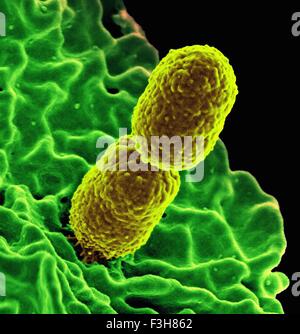 SEM Klebsiella Bakterien weiße Blutkörperchen Stockfoto