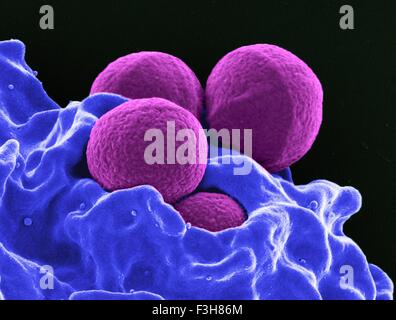Eingefärbte SEM MRSA Bakterien weißer Blutkörperchen Stockfoto