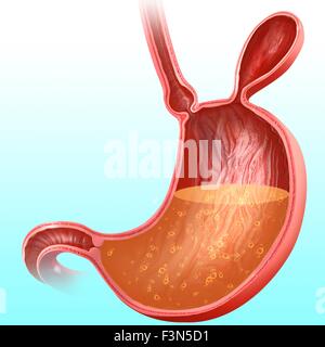 Magen mit Leistenbruch, Abbildung Stockfoto