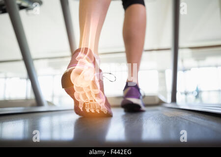 Hervorgehobene Fußknochen Joggen Frau Stockfoto