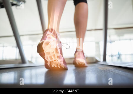 Hervorgehobene Fußknochen Joggen Frau Stockfoto