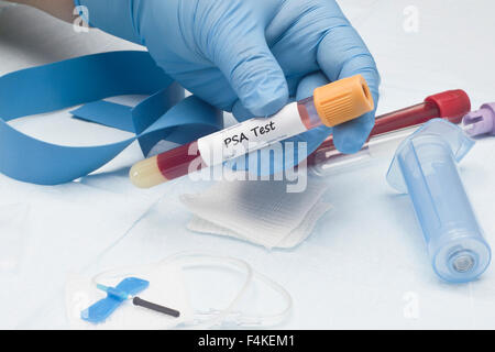 Prostata-spezifisches Antigen PSA Blut Kultur Sammlung Probenröhrchen Stockfoto