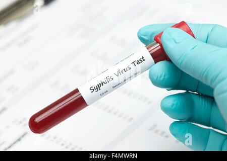 Syphilis-Virus Blut Sammlung Probenröhrchen durch Techniker mit Laborbericht gehalten.  Label ist fiktiv, Seriennummern sind zufällig Stockfoto