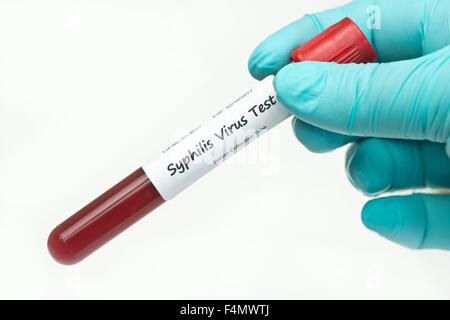Syphilis-Virus Blut Sammlung Probenröhrchen durch Techniker statt.  Label ist fiktiv, Seriennummern sind zufällig und tragen keine rese Stockfoto