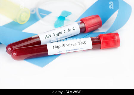 HIV Typ 1 und 2 und Hepatitis B Blutentnahmeröhrchen mit Schmetterling Katheter und Band. Stockfoto