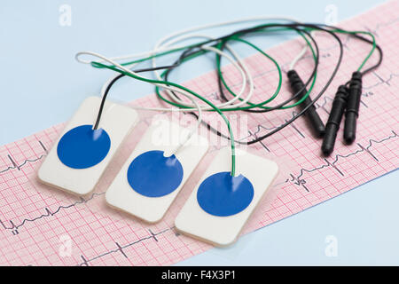 Elektrokardiogramm Leads und EKG auf blaue Tabelle. Stockfoto