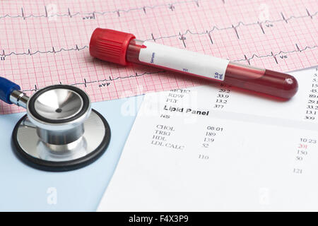 Laborbericht mit Lipid-Panel, Stethoskop, EKG. Stockfoto