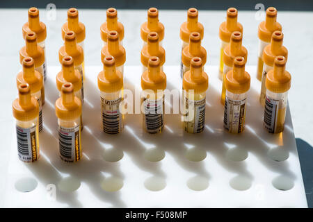 Viele Kapillarrohre, gefüllt mit transparenten Serum, sind in ein weißes Regal sortiert Stockfoto